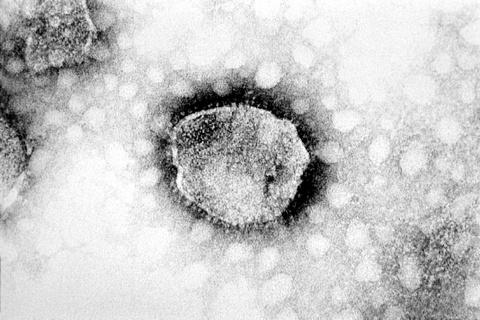 arenavirus