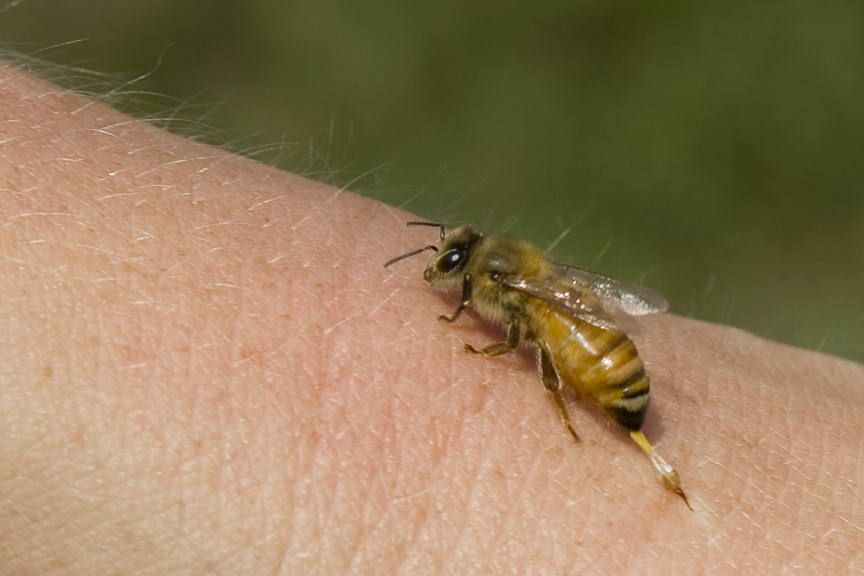 Bee And Wasp Stings : What To Do - Medical News Today