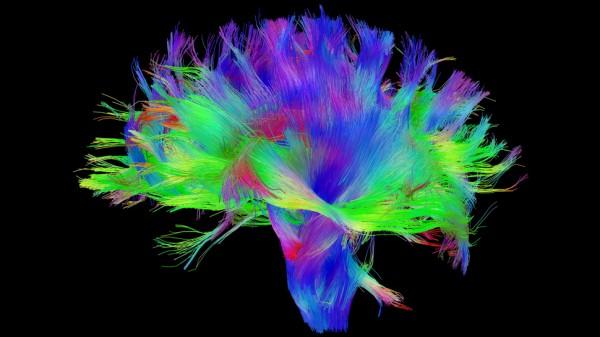 conexos neurais cerebro