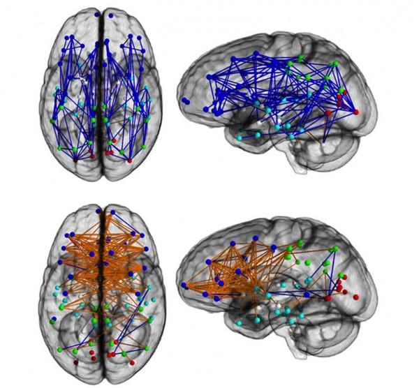 As imagens acima são de cérebros masculinos, e as abaixo femininos
