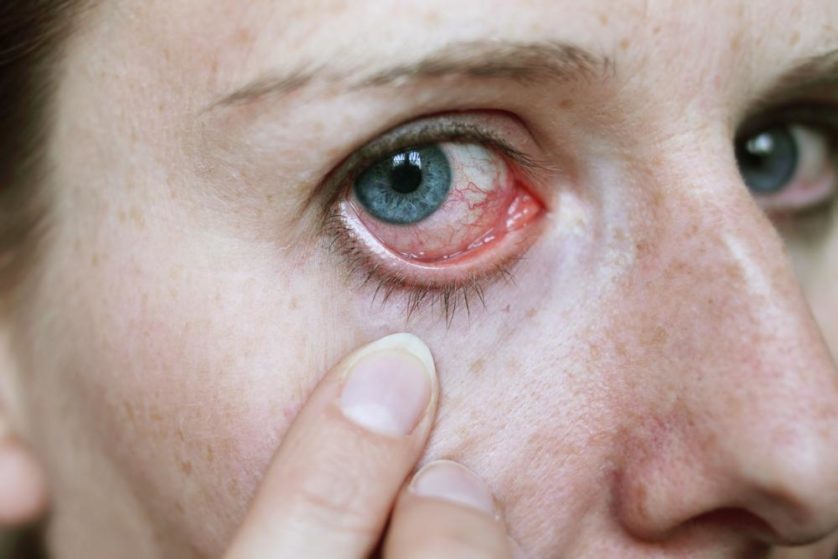 parasita olho lente de contato