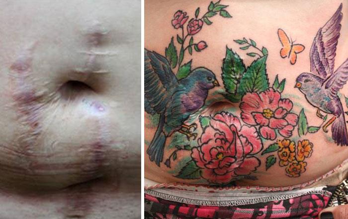 tatuagens-flavia-carvalho-de-sobreviventes-da-violencia-e-cancer-5.jpg?width=600