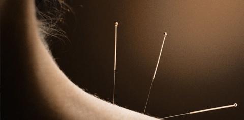 acupuntura acunpuntura acumpumtura