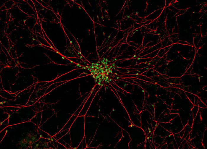 Neurônios Amiotrópicos motores de Esclerose Lateral