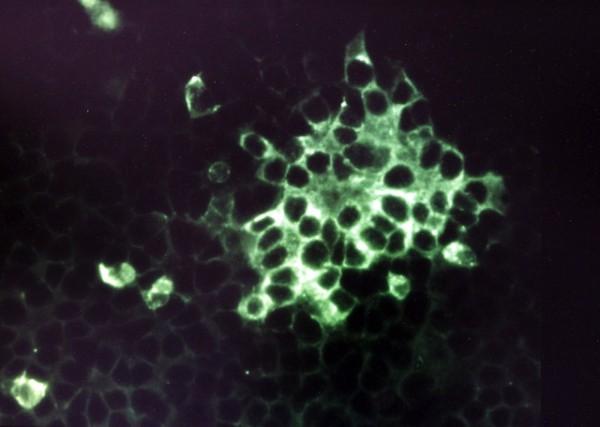 Schmallenberg-Virus verbreitet sich weniger schnell als befuerchtet