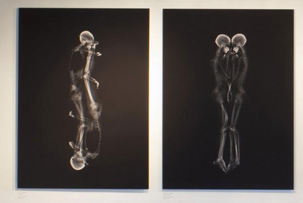 x-ray-couple-portraits-ayako-kanda-mayuka-hayashi-3