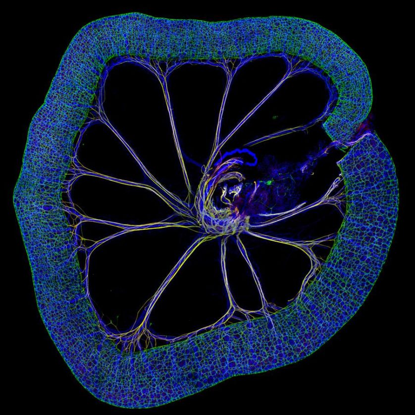Outra menção honrosa foi para esta imagem de um intestino delgado de rato no 15º dia do desenvolvimento embrionário, capturada por John Hatch do National Heart, Lung and Blood Institute, em Bethesda, Maryland (EUA)