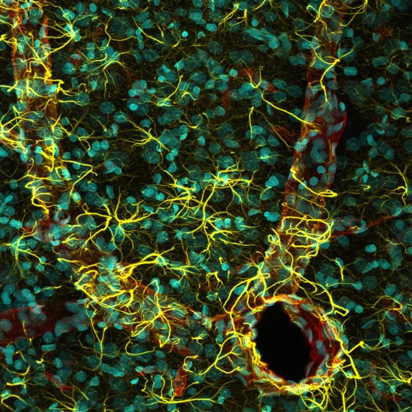 Esta foto do córtex cerebral de um rato mostra núcleos de células em azul, astrócitos em amarelo e vasos sanguíneos em vermelho. Ganhou o quinto lugar para Madelyn May de New Hampshire, EUA