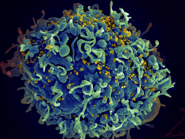 Partículas de HIV infectam uma célula humana.