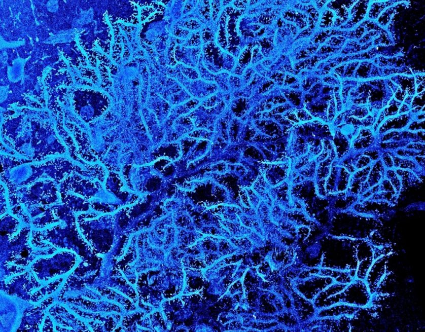 Células de Purkinje e árvore dendrítica no córtex cerebelar de um rato, por Michael Hausser, Sarah Rieubland e Arnd Roth, da University College London (Inglaterra) 