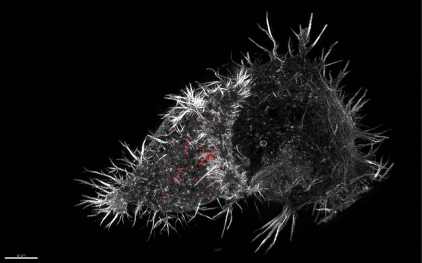Sinapse imunológica da célula exterminadora natural, Nele Dieckermann e Nicola Lawrence, da Universidade de Cambridge (Inglaterra) 