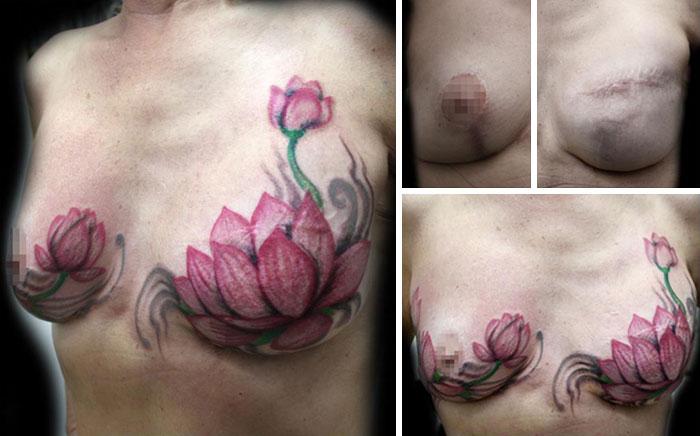 Cobertura de tatuagem flavia carvalho de sobreviventes da violencia e cancer (2)