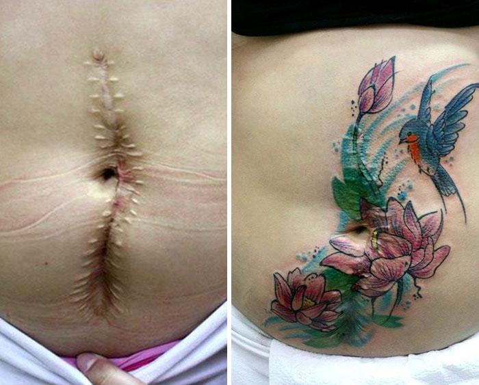 Cobertura de tatuagem flavia carvalho de sobreviventes da violencia e cancer (6)