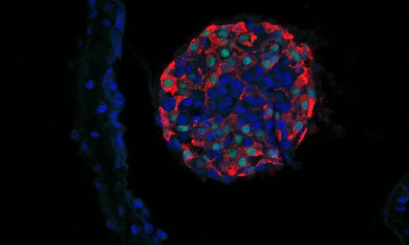Célula beta originada de célula tronco, encapsulada em alginato para protegê-la do sistema imunitário do hospedeiro