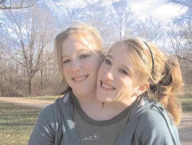 👉Olha que linda história de compartilhamento em só corpo com duas cabeças  femininas😱🧦📢🧐😮🤔👏😍A história de Abby e Brittany Hensel, as famosas  gêmeas conjugadas