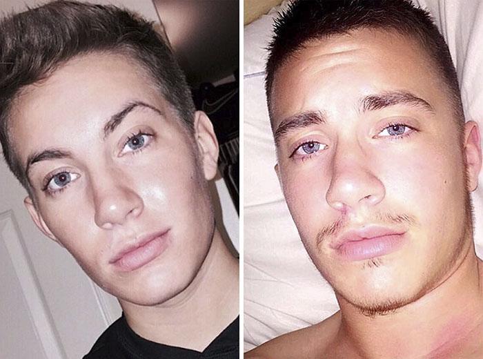Homem Trans Compartilha Fotos Incrveis De Antes E Depois
